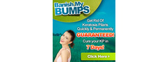 Banish My Bumps brand logo for reviews of online shopping for Personal care products